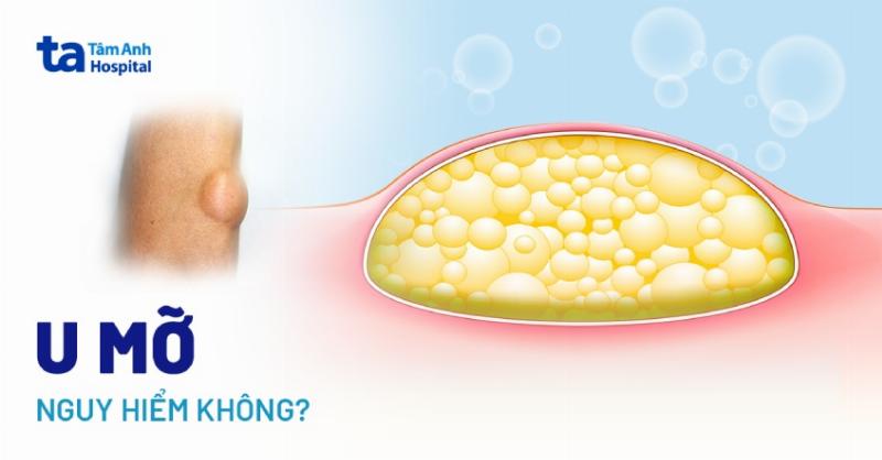 Minh họa hình xăm rắn ở các vị trí khác nhau trên cơ thể như cổ, vai, ngực, ngón tay.