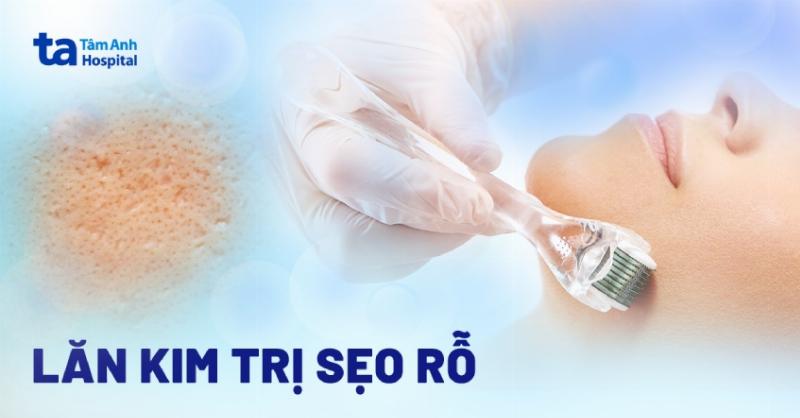 Quy trình lăn kim trên da mặt, cùng với lọ tinh chất tế bào gốc Hàn Quốc và thiết bị lăn kim