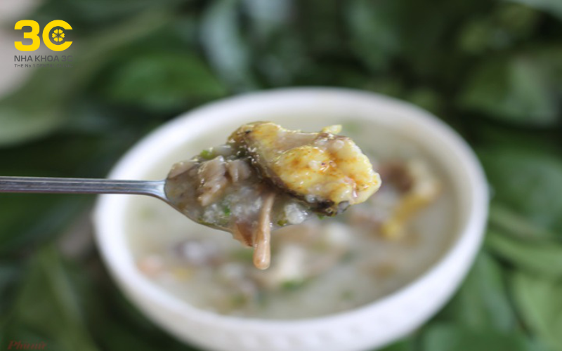 Lời khuyên chuyên gia niềng răng