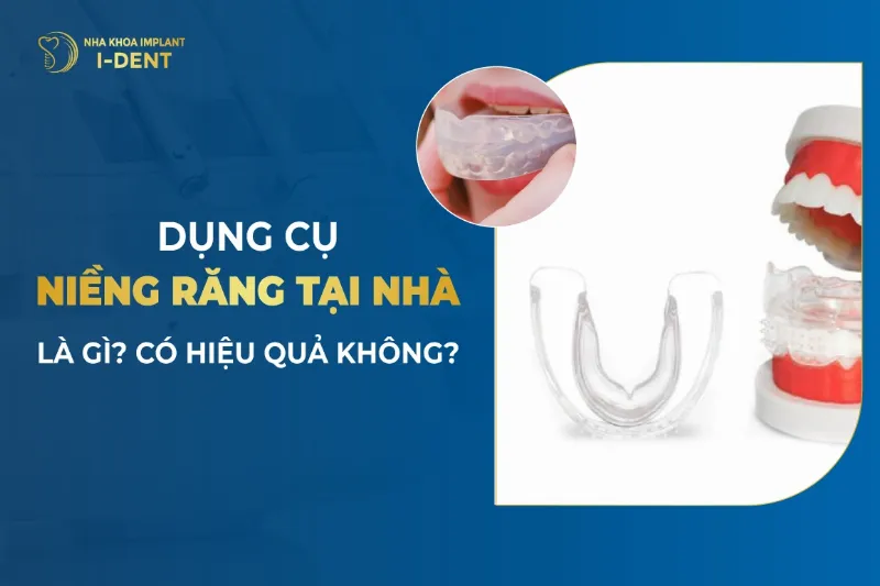 Các phương pháp niềng răng tại nhà