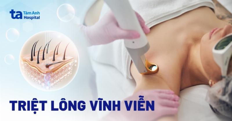 Hinh anh minh hoa cac buoc ve sinh vung nach va lan san pham, the hien su sach se va cham soc