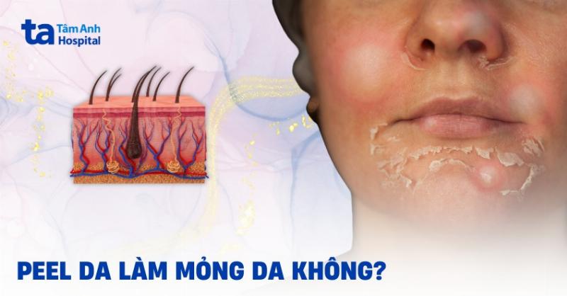 Chân dung giả định của Bác sĩ Nguyễn Minh Anh, chuyên khoa Da liễu, đang đưa lời khuyên về peel da The Ordinary.