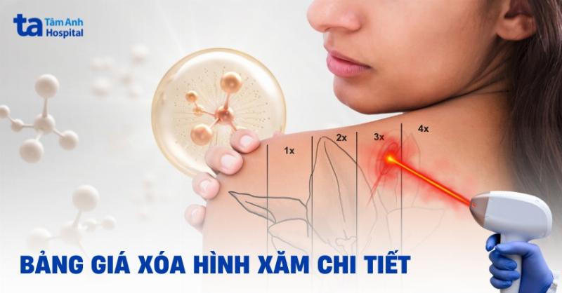 Qua trinh thuc hien hinh xam rong full lung doi hoi su ti mi