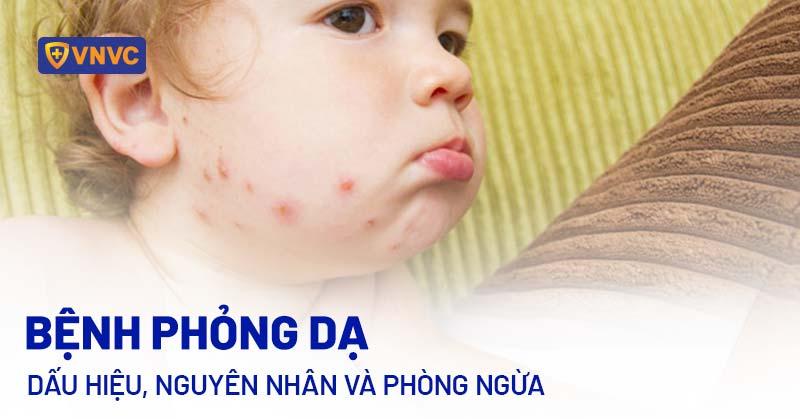 Hinh anh cac bieu tuong canh bao: khong dung tren da ton thuong, tranh xa tam tay tre em, chi dung ngoai da