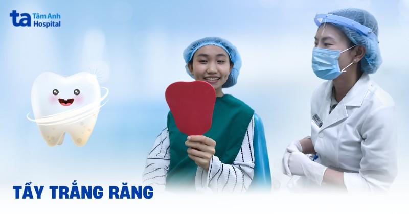 Hình ảnh so sánh trực quan hiệu quả làm trắng răng của các phương pháp khác nhau (kem đánh răng, miếng dán, tẩy trắng tại nha sĩ).