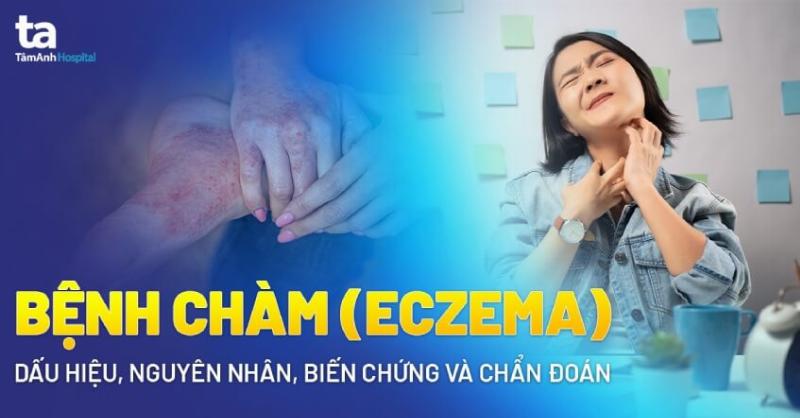 Hinh anh vi thuoc say xe 4 vien tren long ban tay, san sang cho chuyen di