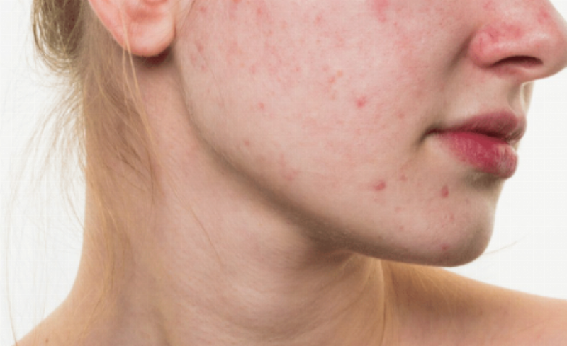 Biểu đồ hoặc hình ảnh minh họa các ưu điểm vượt trội của sữa rửa mặt Bioderma (độ pH cân bằng, không xà phòng, phức hợp sinh học, dịu nhẹ) so với sữa rửa mặt thông thường.